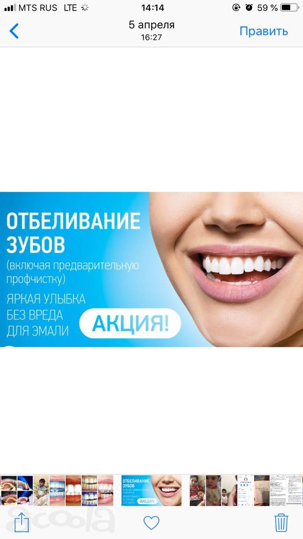 Акция на профессиональную чистку зубов и лечение кариеса